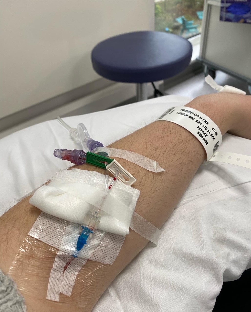 Chemo Week 1 